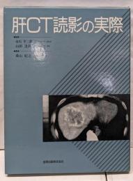 肝CT読影の実際