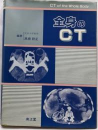 全身のCT