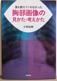 誰も教えてくれなかった胸部画像の見かた・考えかた