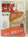 病気がみえる vol.1 消化器 第6版 メディックメディア 医療情報科学研究所
