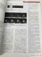 月刊インナービジョン2019年8月号Vol.34, No.8─特集：Breast Imaging Vol.14；Precision Medicine時代におけるライフステージと乳がん画像診断[雑誌] インナービジョン