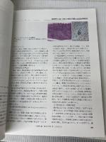 肝胆膵画像 2010年 05月号 [雑誌] 医学書院