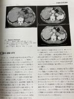 肝胆膵画像 2010年 09月号 [雑誌] 医学書院
