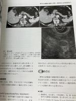 肝胆膵画像 2010年 07月号 [雑誌] 医学書院