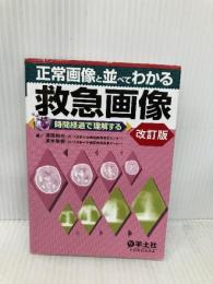 正常画像と並べてわかる 救急画像 改訂版 〜時間経過で理解する 羊土社 清田和也
