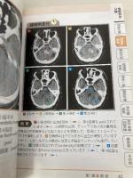 正常画像と並べてわかる 救急画像 改訂版 〜時間経過で理解する 羊土社 清田和也