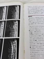 【※カバー無し・イタミ有り】脊髄: 機能・解剖・手術 (図説脳神経外科NewApproach 7) メジカルビュー社