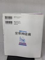 【※イタミ有り】図解でわかる坐骨神経痛 (徹底対策シリーズ) 主婦の友社