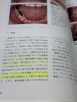 【※カバー無し・書き込み有り】咬合性外傷の早期診断と治療法: 顎態からのアプローチ クインテッセンス出版 野田 隆夫