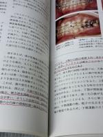 【※カバー無し・書き込み有り】咬合性外傷の早期診断と治療法: 顎態からのアプローチ クインテッセンス出版 野田 隆夫