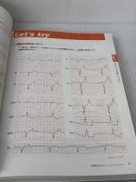 心電図の読み方パーフェクトマニュアル―理論と波形パターンで徹底トレーニング! 羊土社