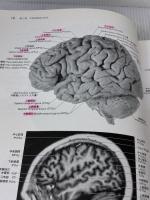 【※書き込み有り】ハインズ神経解剖学アトラス 第3版 メディカルサイエンスインターナショナル デュアン・E. ハインズ