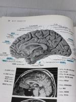 【※書き込み有り】ハインズ神経解剖学アトラス 第3版 メディカルサイエンスインターナショナル デュアン・E. ハインズ