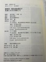 脳梗塞、脳出血後遺症が見違えるほど回復した！