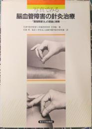写真でみる脳血管障害の針灸治療　 「醒脳開竅法」の理論と実際