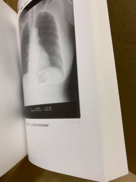 じん肺 : 臨床・予防管理・補償のすべて / 古本、中古本、古書籍