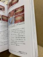 Dental Diamond　第37巻8号　2012年6月　パーシャルデンチャーのベーシックスキル