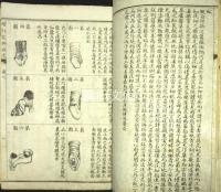 黴瘡秘録上巻・下巻・花柳指迷　揃