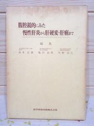 腹腔鏡的にみた慢性肝炎から肝硬変・肝癌まで