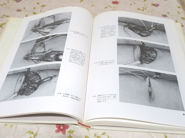 図説ブラッドアクセス : 作り方と使い方