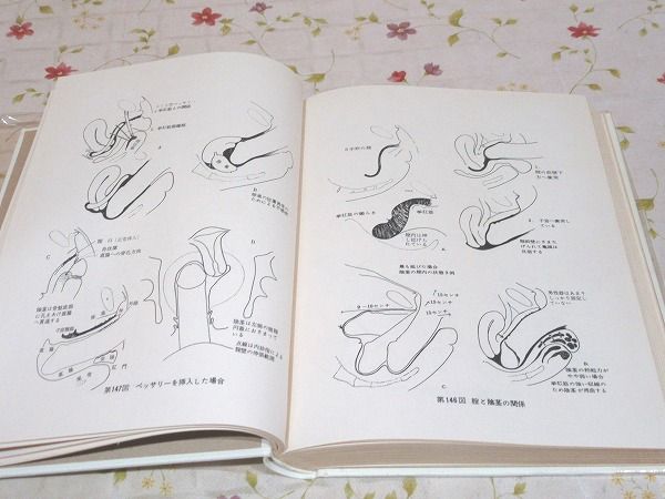 完訳・人体性解剖学図説(ロバート・L・ディッキンソン 金子栄寿 完訳・人体性解剖学図説(ロバート・L・ディッキンソン 金子栄寿
