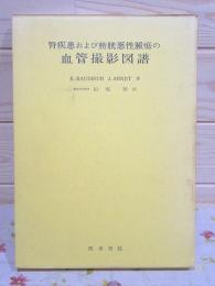 腎疾患および膀胱悪性腫瘍の血管撮影図譜