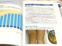 膝痛 こだわりの保存治療