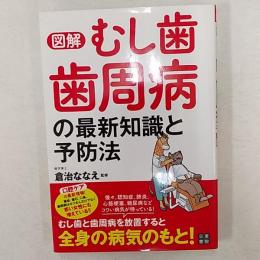 図解むし歯・歯周病の最新知識と予防法