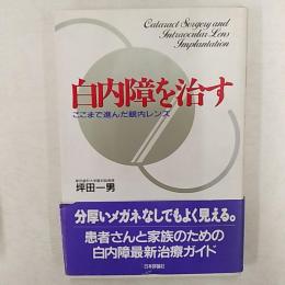 白内障を治す