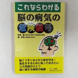 これならわかる脳の病気の危険信号