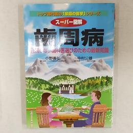 スーパー図解歯周病 : 後悔しない歯科医選びのための最新知識