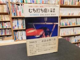 「むち打ち症と交通事故 」　治療の実際と補償のすべて