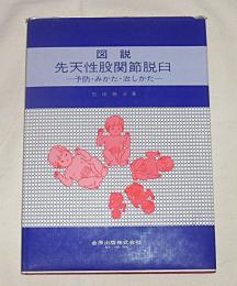 図説先天性股関節脱臼 : 予防・みかた・治しかた