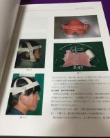 反対咬合の矯正診断と治療