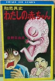 胎児異変　わたしの赤ちゃん　ヒットコミック53