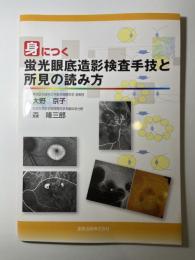 身につく蛍光眼底造影検査手技と所見の読み方