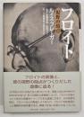 フロイト : 視野の暗点