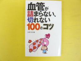 血管が詰まらない、切れない100のコツ