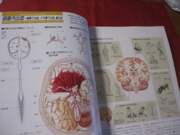 病気の地図帳 増補改訂版 病気の地図帳 増補改訂版 : 矢﨑