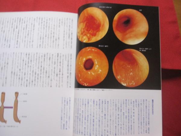 驚異の小宇宙 人体 ◇消化吸収の妙 胃・腸 NHK サイエンス