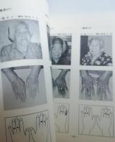 南島入墨習俗の研究　トヨタ座談助成研究報告書　（針突・ハヂチ・沖縄・琉球・台湾）