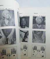 南島入墨習俗の研究　トヨタ座談助成研究報告書　（針突・ハヂチ・沖縄・琉球・台湾）