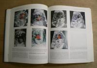 Textbook of Fetal Cardiology