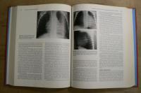 Fetal, Neonatal, and Infant Cardiac Disease