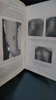医学　洋書　ドイツ語　SPEZIELLE  PATHOLOGIE und THERPIE 病理学・治療法　　第１巻・第2巻　2冊一括