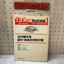 3_   イラストでみる今日の眼科手術 ES Now illustrated 1 Eye Surgery 白内障手術 術中・術後合併症対策 1996年11月 初版 メジカルビュー