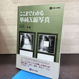 1_　ここまでわかる単純X線写真 090239